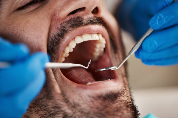 Best Urgent Tooth Repair  in Isla Vista, CA